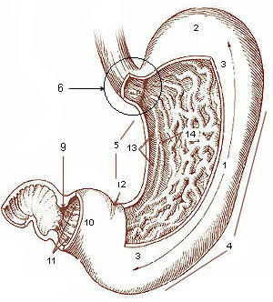 Kiriakou's gastrectomy